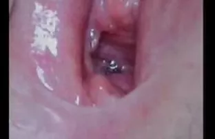 লেবানন এরোটিকা 6 থেকে 4 পদক্ষেপ